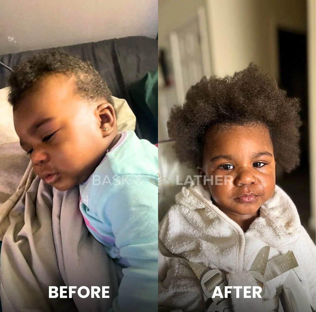 Nurture & Grow - Kids Healthy Hair Bundle - Image 4