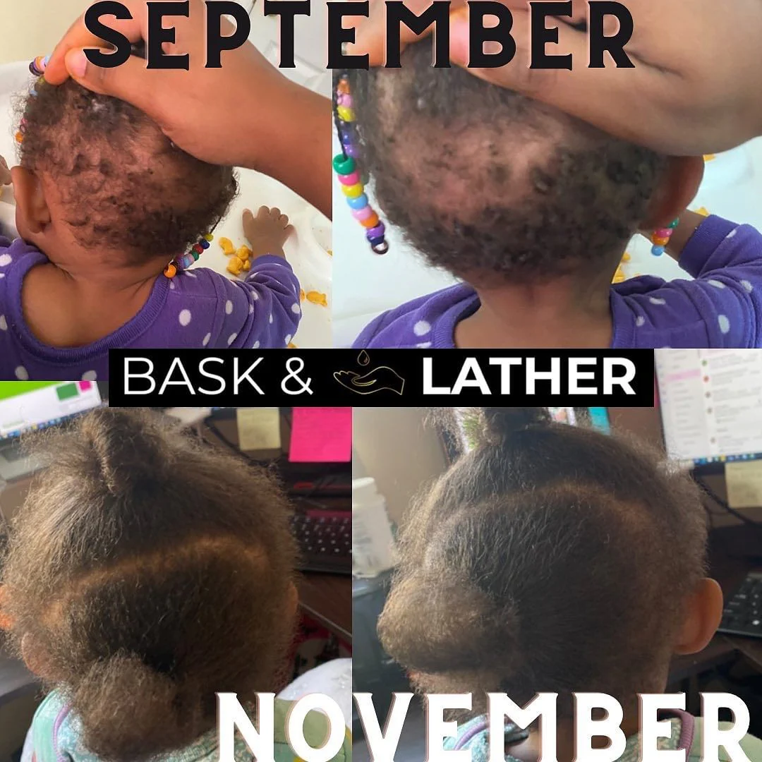 Nurture & Grow - Kids Healthy Hair Bundle - Image 5