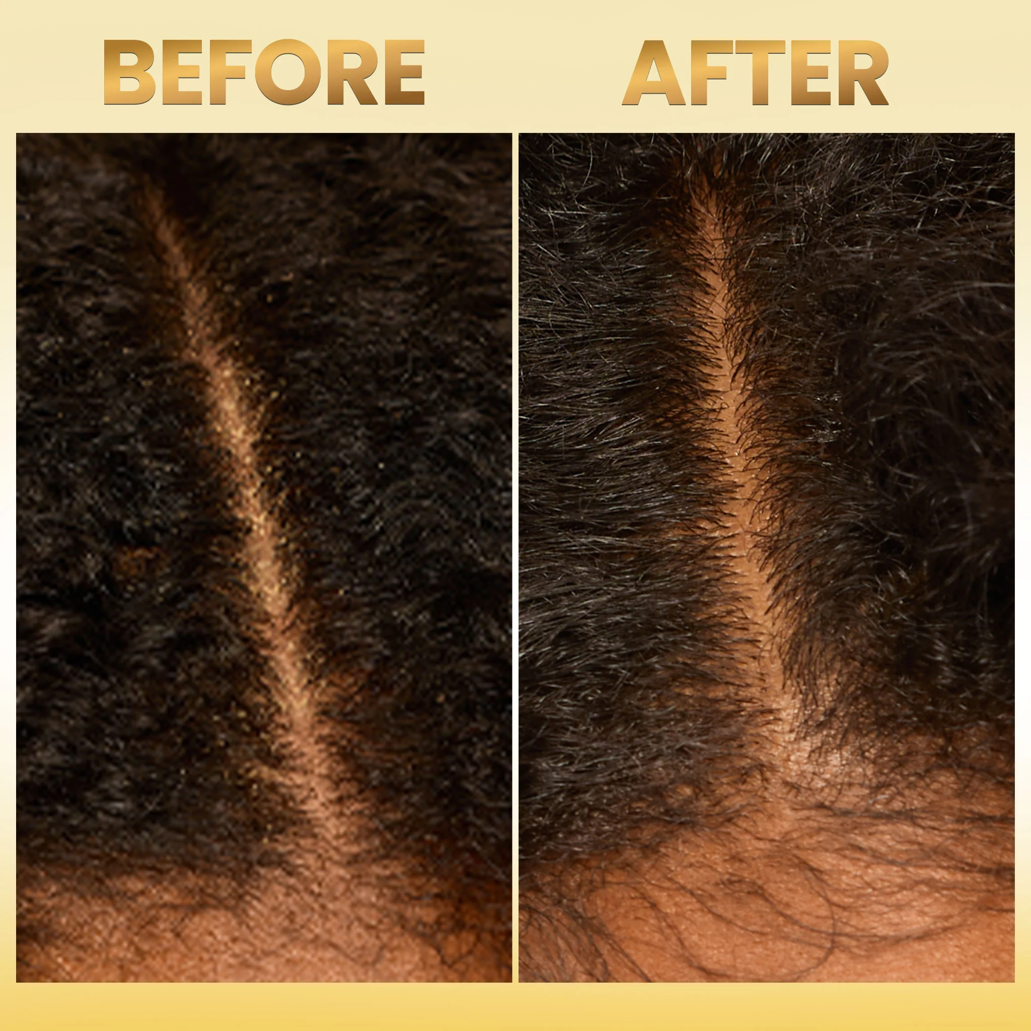 Scalp Moisturizing Leave-In Treatment - Image 5