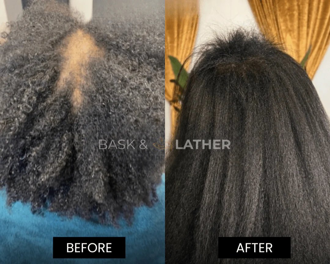 XL Cleanse & Growth Bundle - For Moisture & Hydration - Image 2